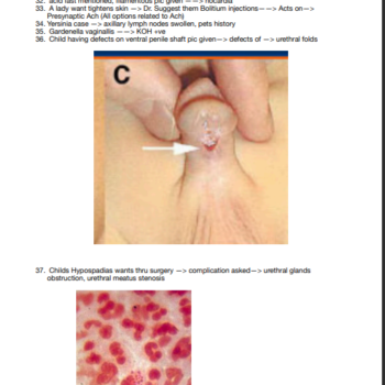 USMLE Step 1 Recalls 2025-26