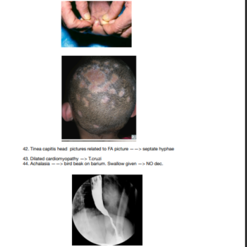 USMLE Step 1 February 2025 Recalls Bundle